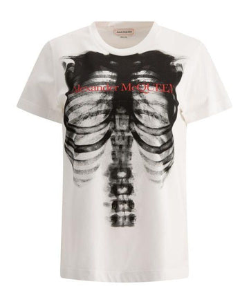ALEXANDER MCQUEEN リップケージプリントTシャツ 797812 QZAM3 0900 152200346 [P]